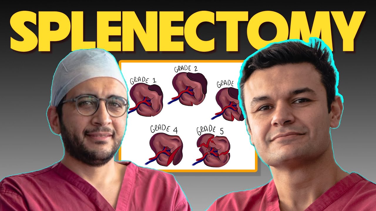 Ep11: splenectomy for FRCS general surgery exams