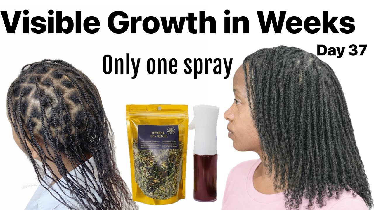 Don’t let them lie to you. Hair can grow within weeks. Mine did . Day 37
