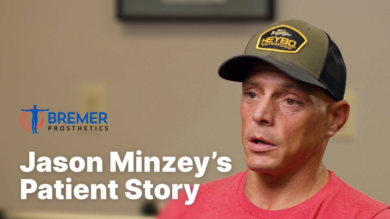 Jason Minzey's Amputation & Prosthetic Patient Story