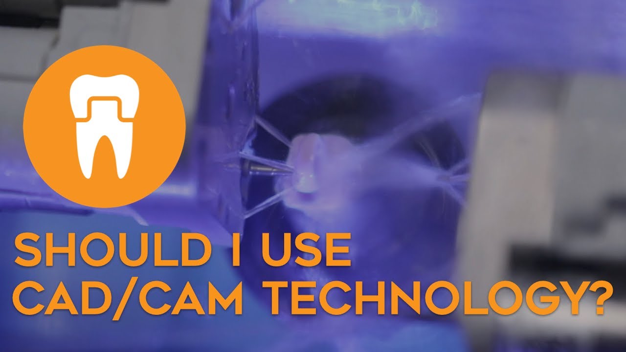 Стоит ли использовать технологию CAD/CAM?