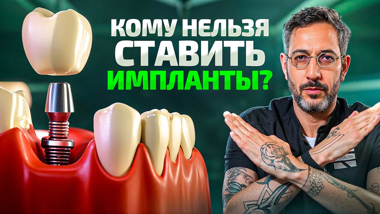 НЕудобная правда про зубные импланты. Никогда их НЕ ставьте, если...
