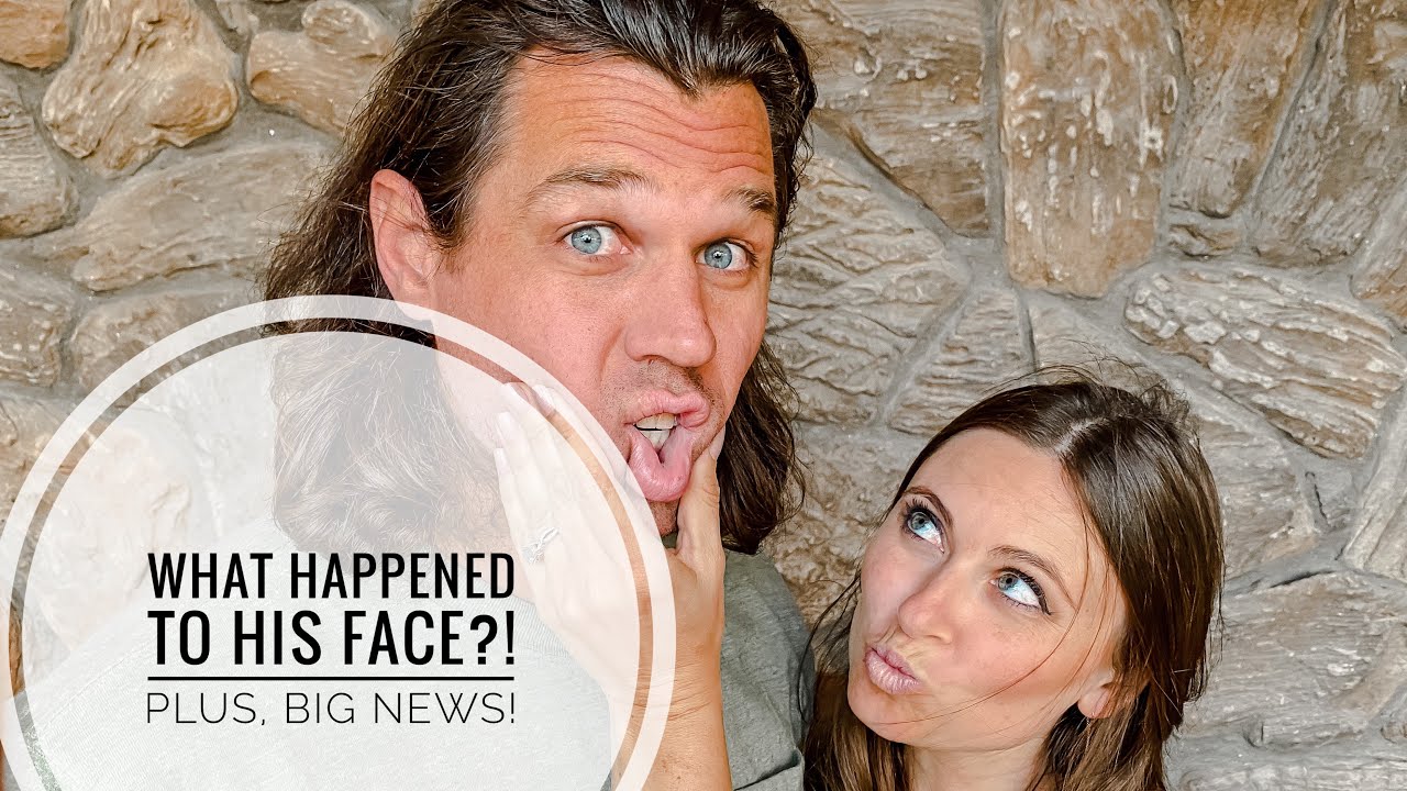 What happened to his FACE? Plus, our big news!!
