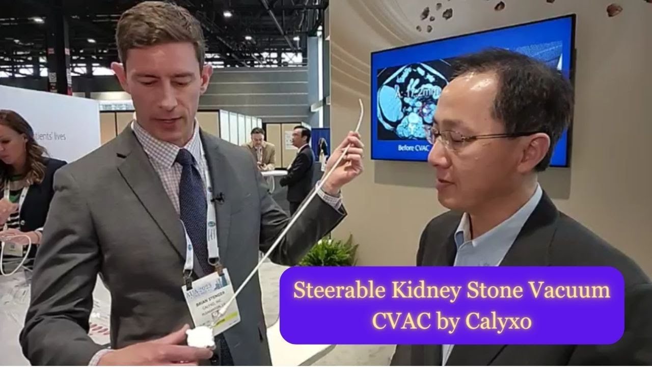 CVAC by Calyxo: Steerable Kidney Stone Fragment Vacuum