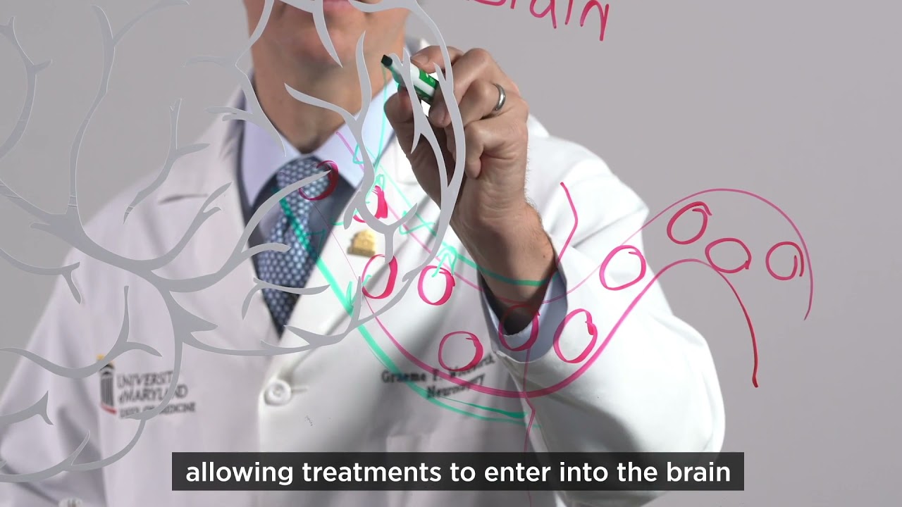 Treating Brain Tumors Using Focused Ultrasound