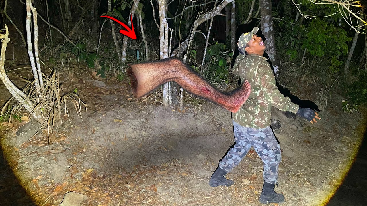 LEVEI UM CHUTE DA PERNA CABELUDA NAS COSTAS - Imagens fortes 👣😱