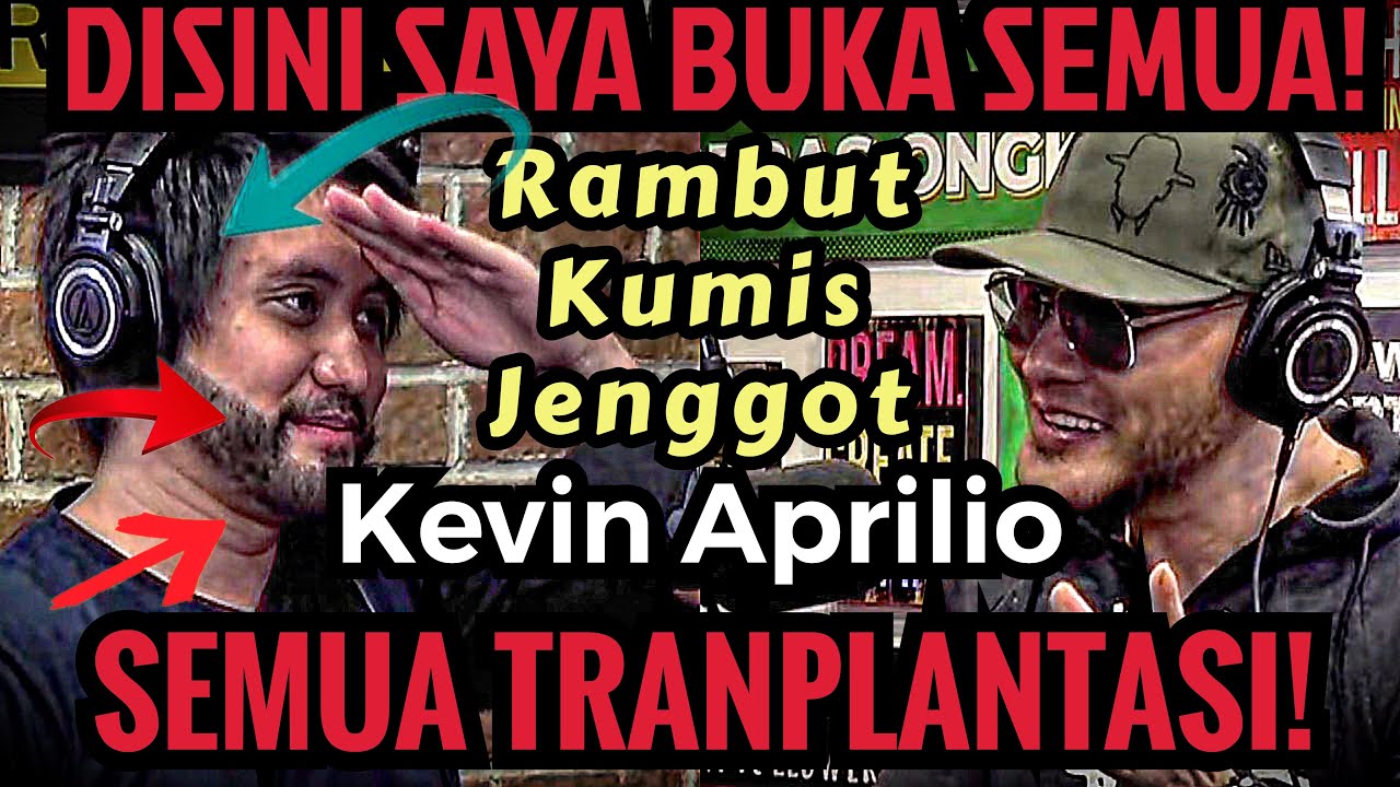 SAKSIKAN‼️ HASIL AKHIR TRANPLANTASI JENGGOT DI TURKI‼️ EXCLUSIVE - KEVIN APRILIO - DC Podcast