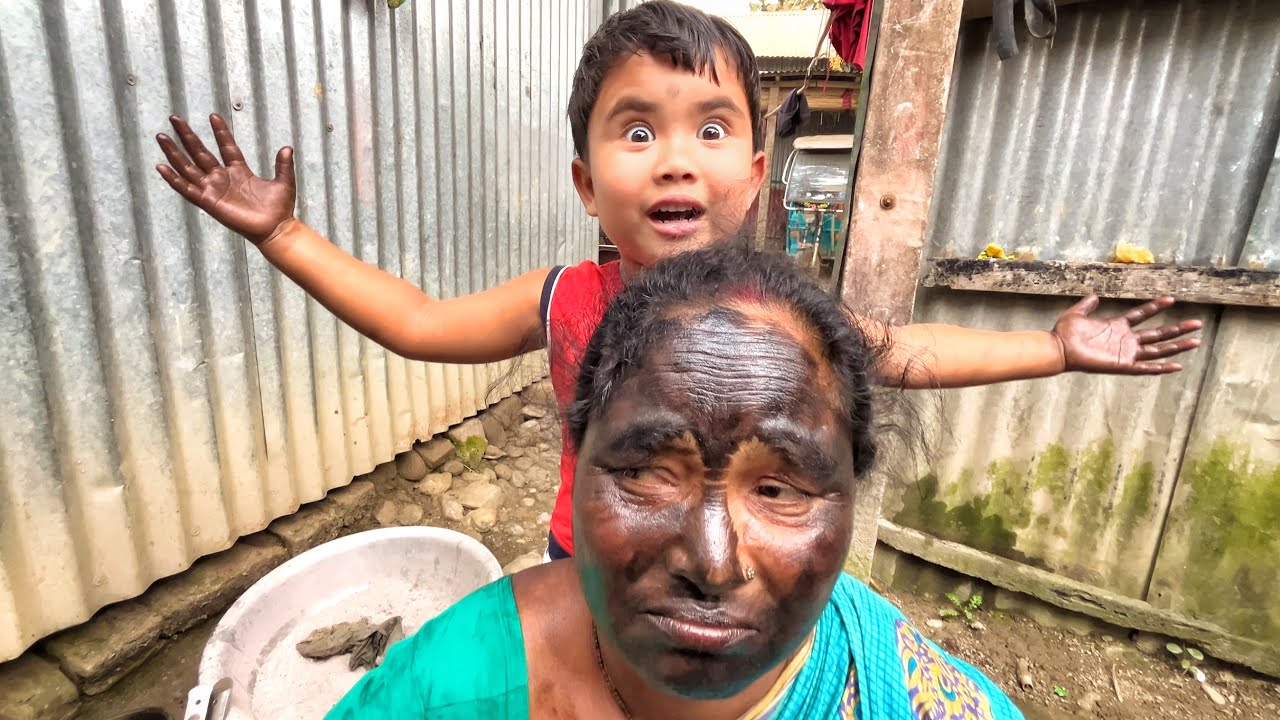 একি অবস্থা করলো মুখের! 🥱 ||  Goriber Vlogs