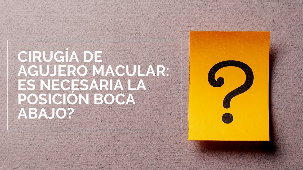 Ep 07 - Posición boca abajo para cirugía de Agujero Macular necesaria?