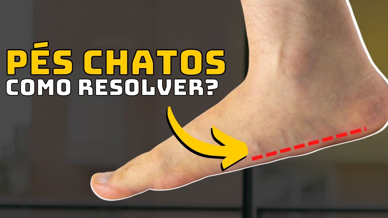 3 melhores exercícios para corrigir PÉS CHATOS | PISADA PRONADA