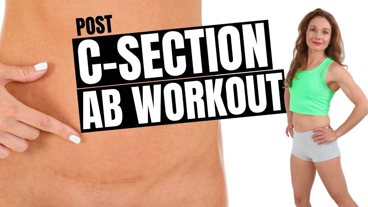 Post C Section Abdominal Workout | C SECTION RECOVERY EXERCISES | STRONG CORE & FLAT TUMMY