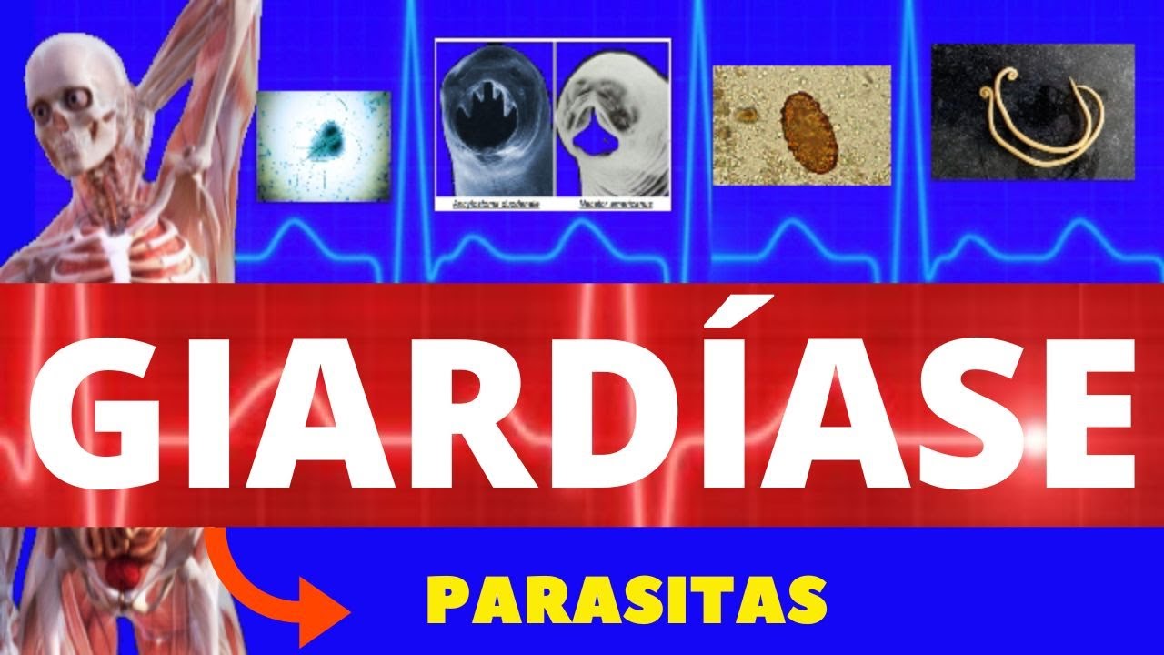 GIARDÍASE - GIARDIA LAMBLIA (GIARDIA) - PARASITOLOGIA /INFECTOLOGIA - (ENSINO SUPERIOR)