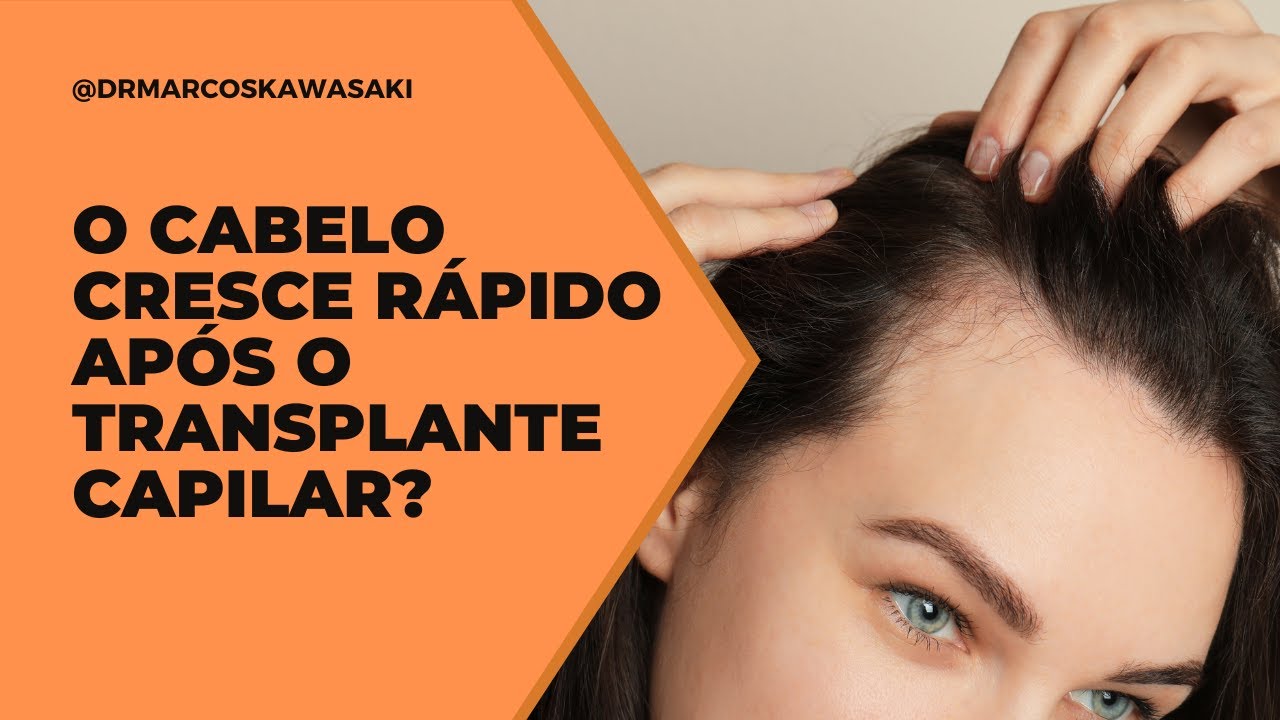 O cabelo cresce rápido após o transplante capilar?