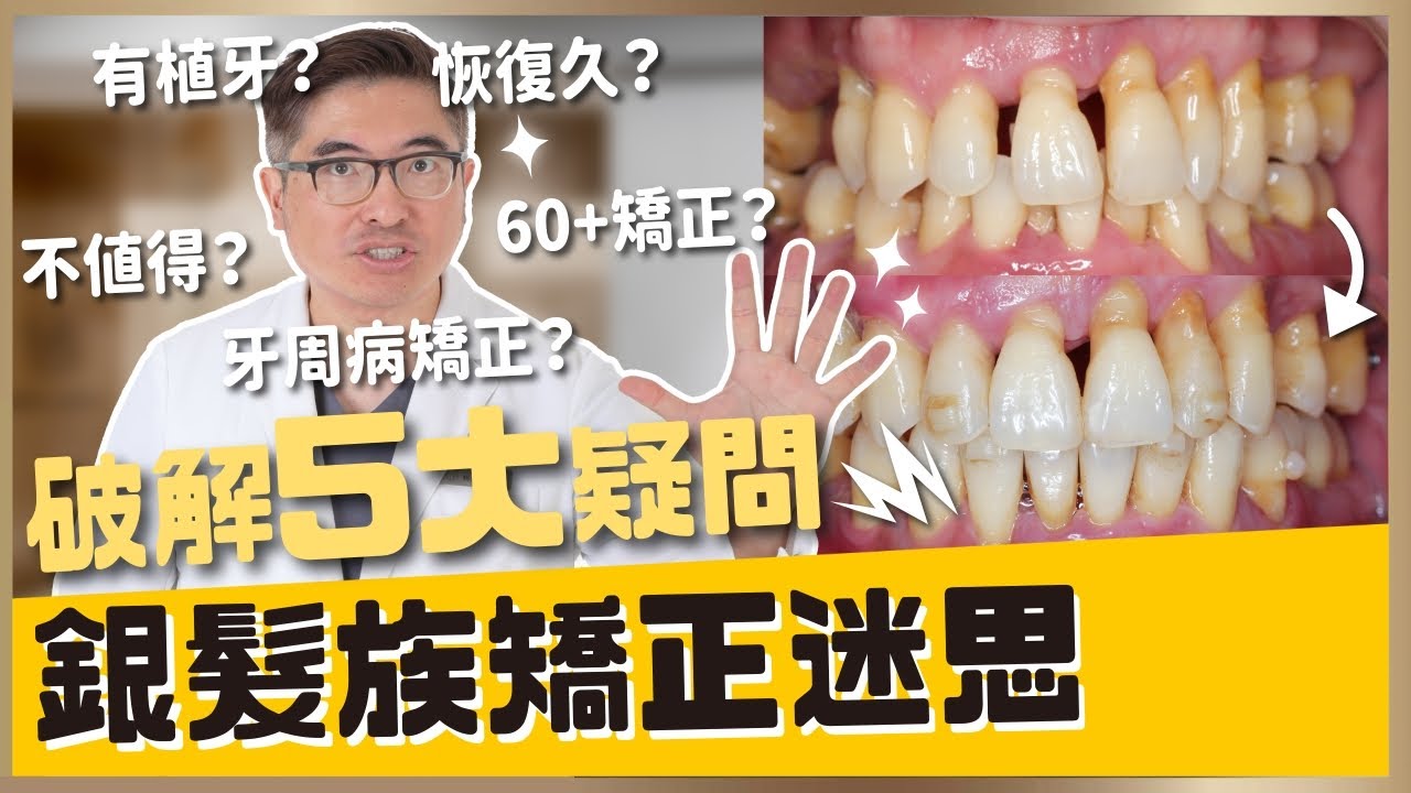 【隱適美矯正 #31】60歲後還能矯正牙齒嗎？破解銀髮族牙齒矯正五大迷思！｜【祐民牙醫－隱適美旗艦店】鑽石級楊大為醫師