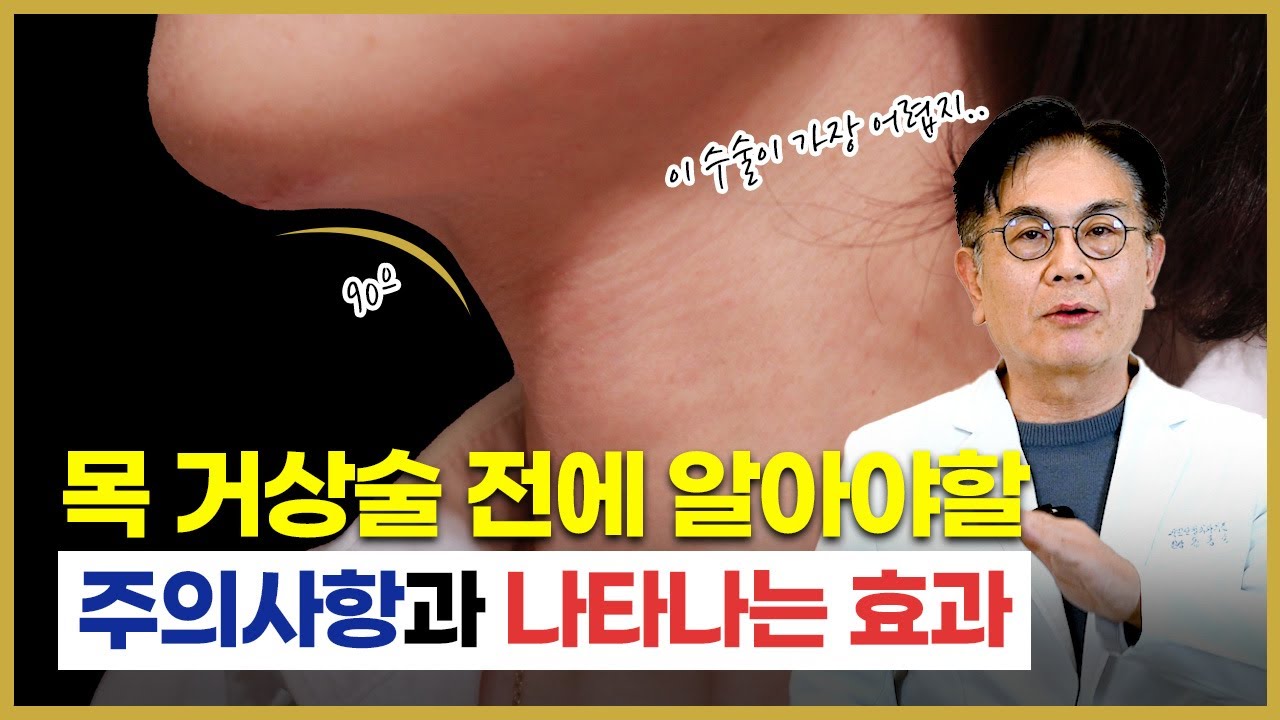 목 거상술 효과와 알아야 할 주의사항은 무엇일까?