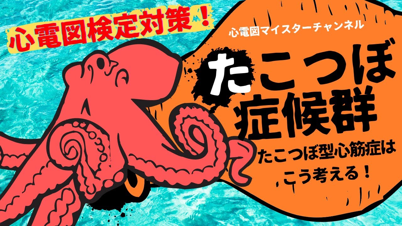 【心電図検定対策】たこつぼ症候群　たこつぼ型心筋症　診断・心電図・治療・合併症