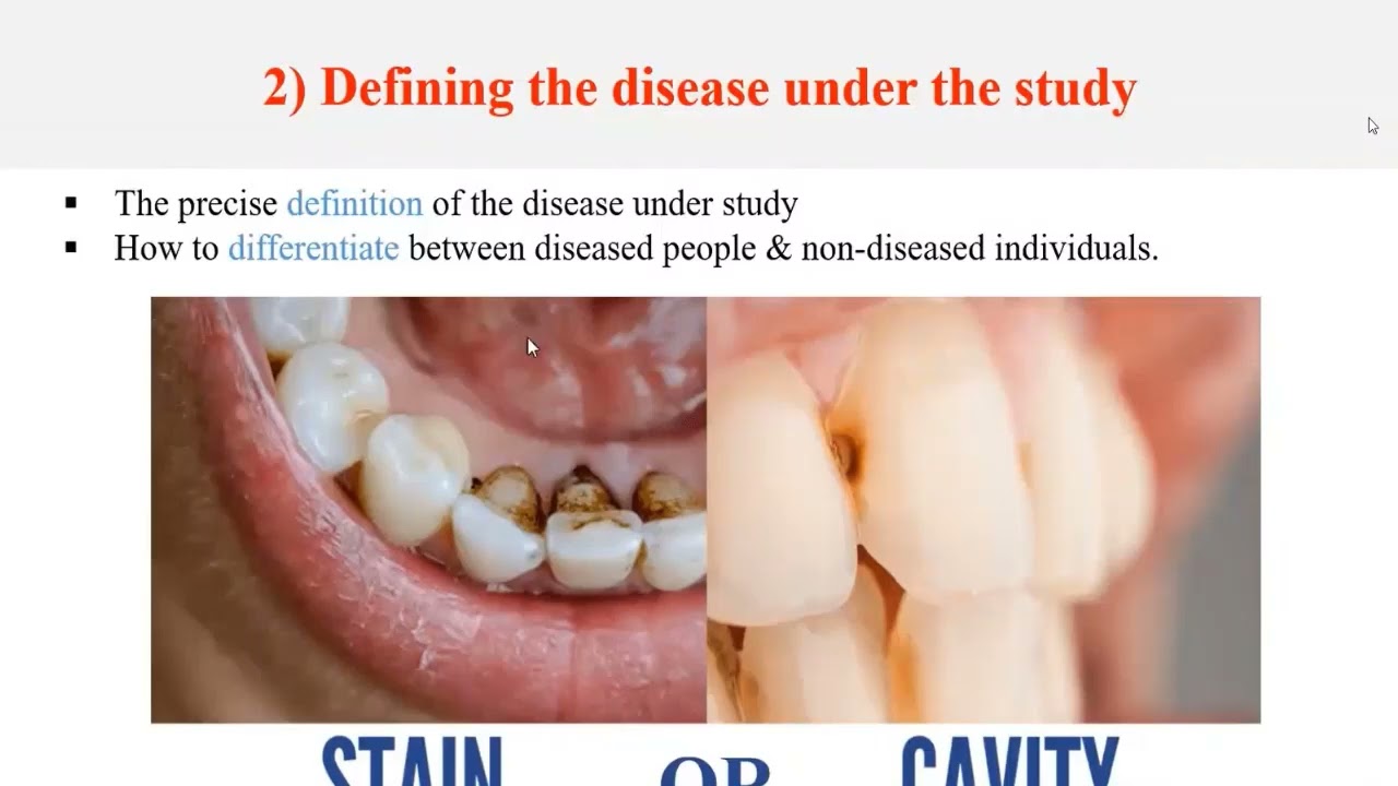 Preventive Lec 8 - General Epidemiology & Epidemiology of Dental Caries