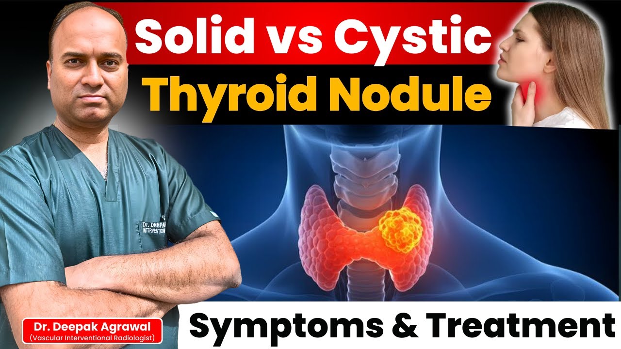Solid vs Cystic Thyroid Nodule - Which Is Dangerous? |  Treatment Without Surgery