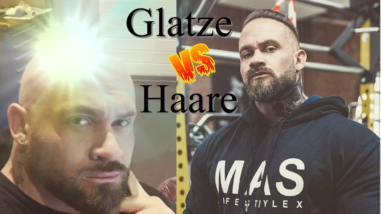 Glatze rasieren nach Haartransplantation