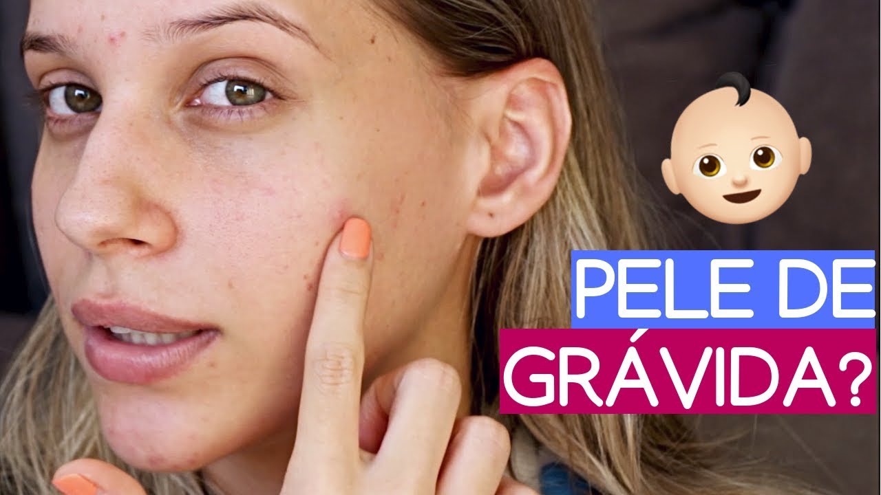 4 MESES SEM ANTICONCEPCIONAL - O QUE MUDOU?