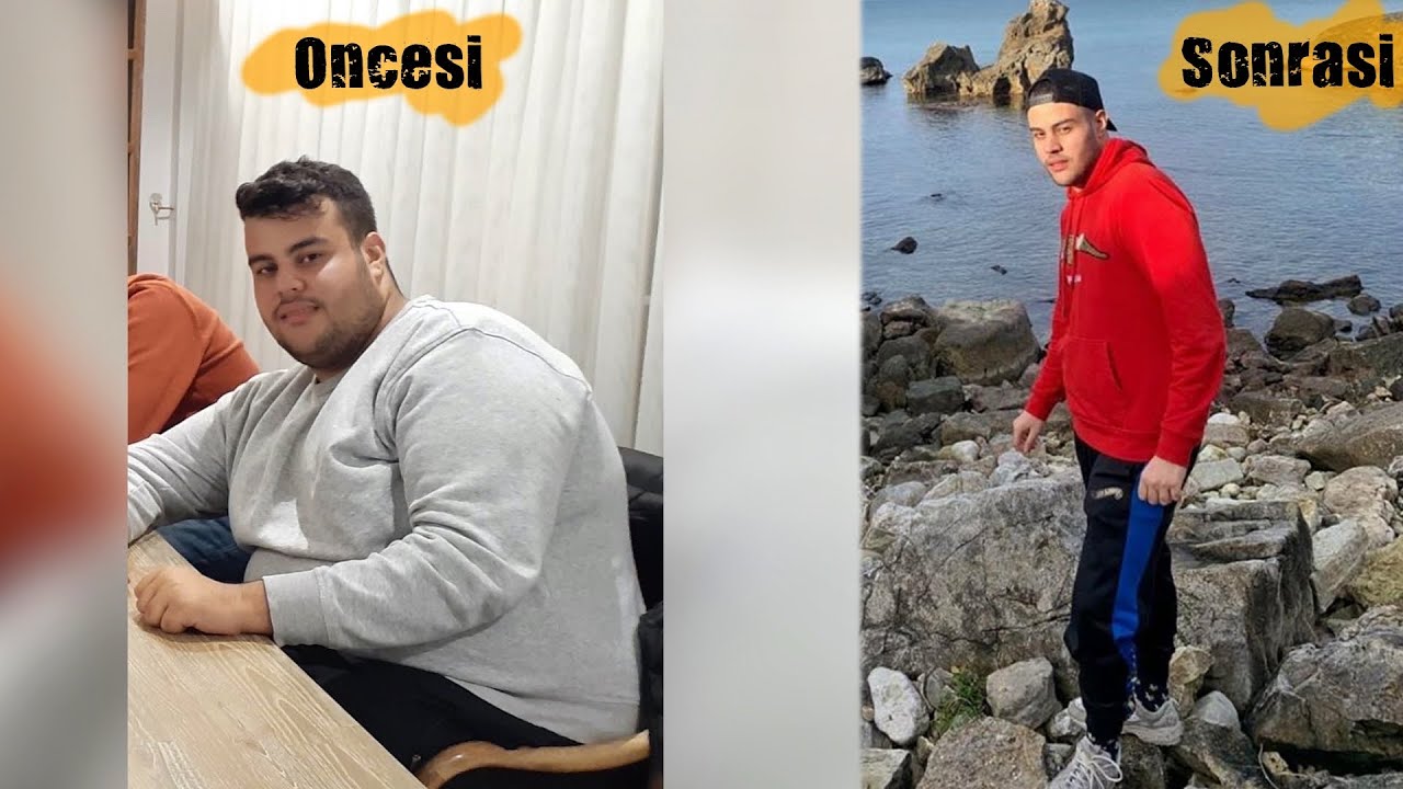 7 Ayda 65 Kilo Nasıl Verilir (Ameliyatsız Tamamen Sağlıklı Yollarla)