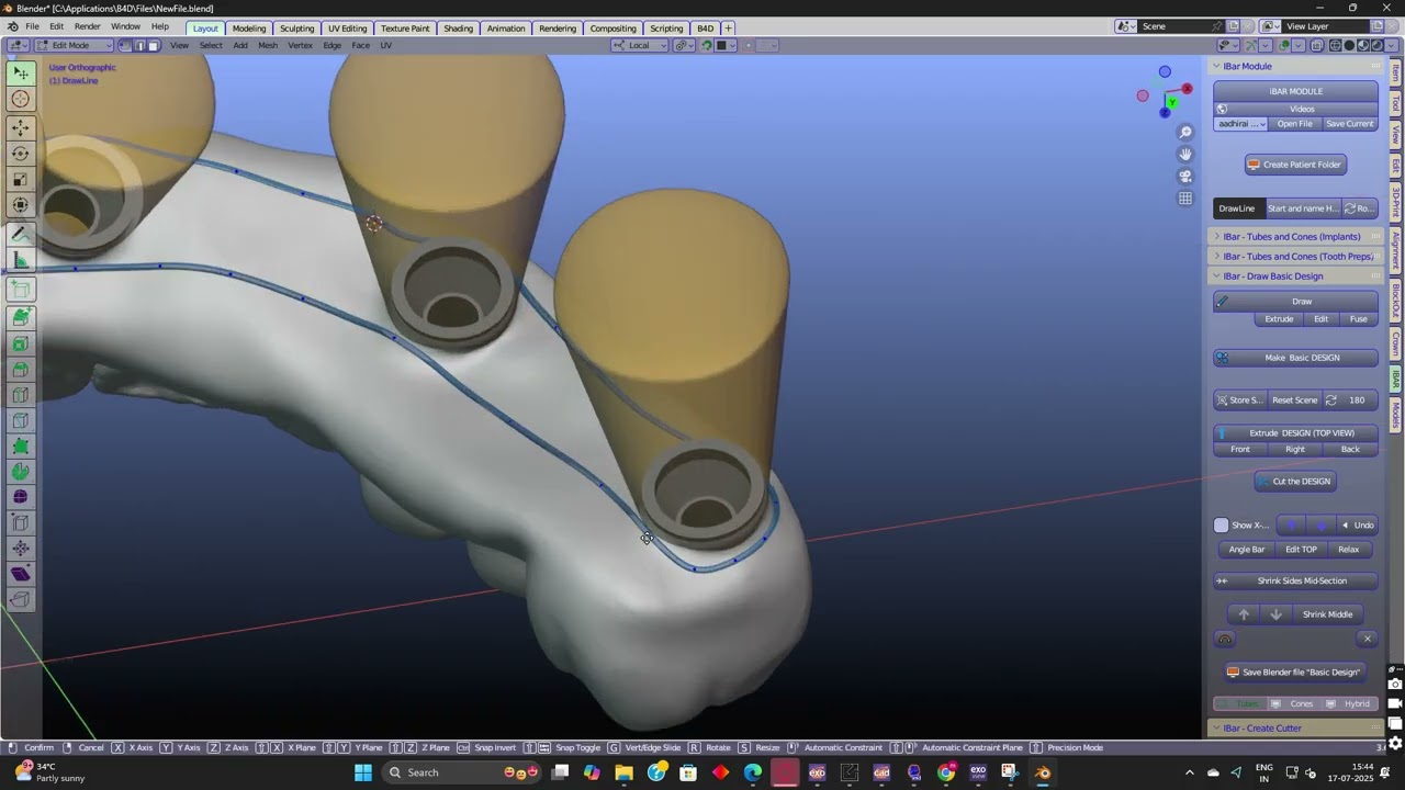 I bar designing for full arch all on x mu implants
