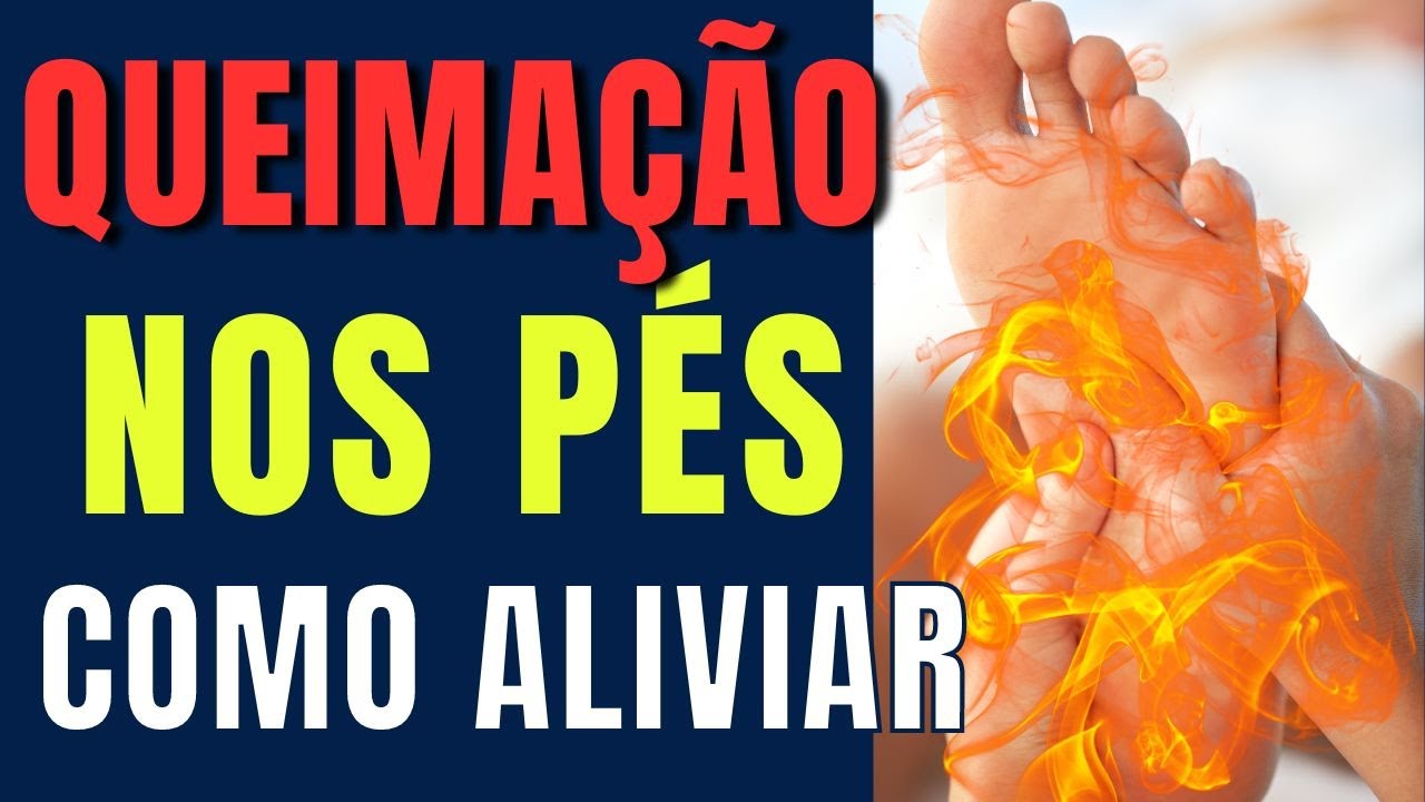 5 Dicas para Acabar com a Queima&ccedil;&atilde;o nos P&eacute;s
