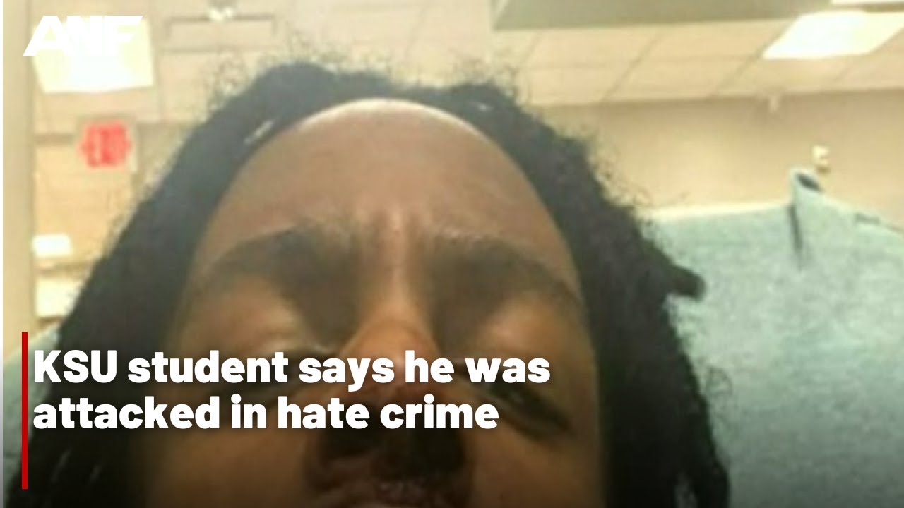 KSU student says he was attacked in hate crime