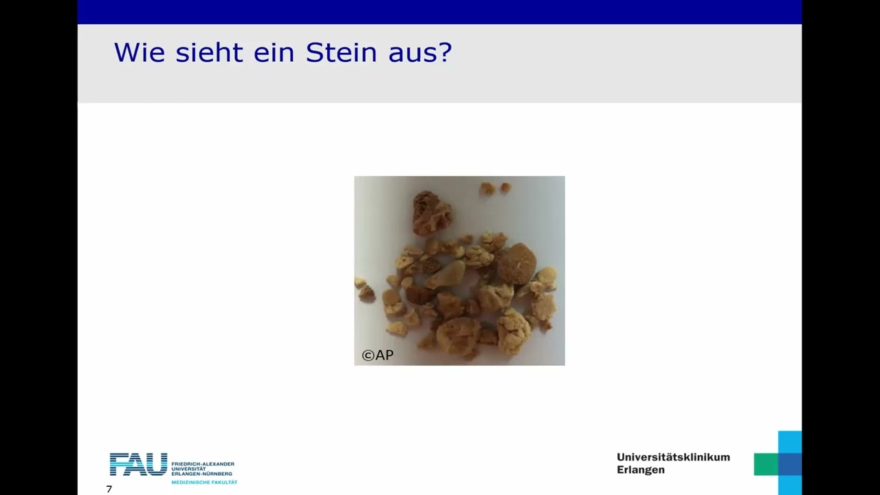 DZI-Webinar „Nierensteine – was tun, wenn sie immer wieder kommen?“, 17.09.2025