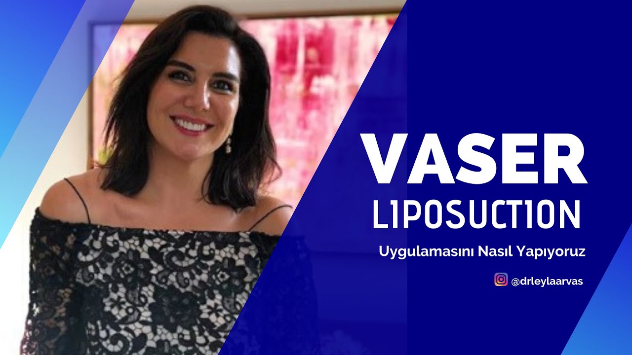 Vaser Liposuction Nedir? | V&uuml;cut Şekillendirme | Op. Dr. Leyla Arvas