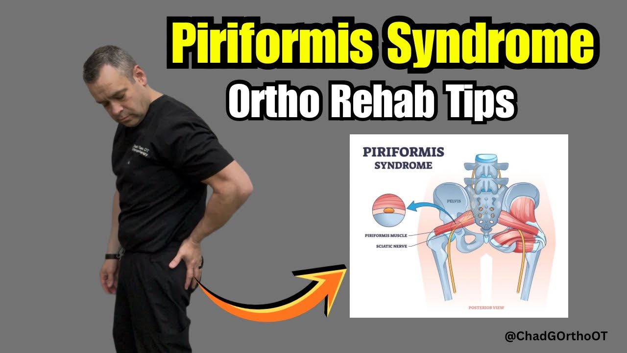 Piriformis Syndrome: Why It Causes Sciatica & Buttock Pain. Tips to help! 