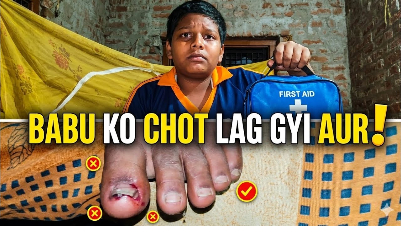Babu ko chot lag gyi 😰
