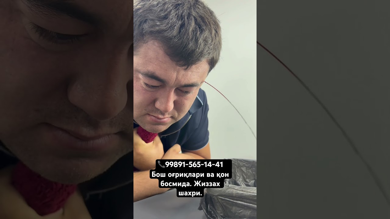 Чертма хижома жиззах хижома. 📞99891-565-14-41 хижомани фойдаси. #hijama #massage
