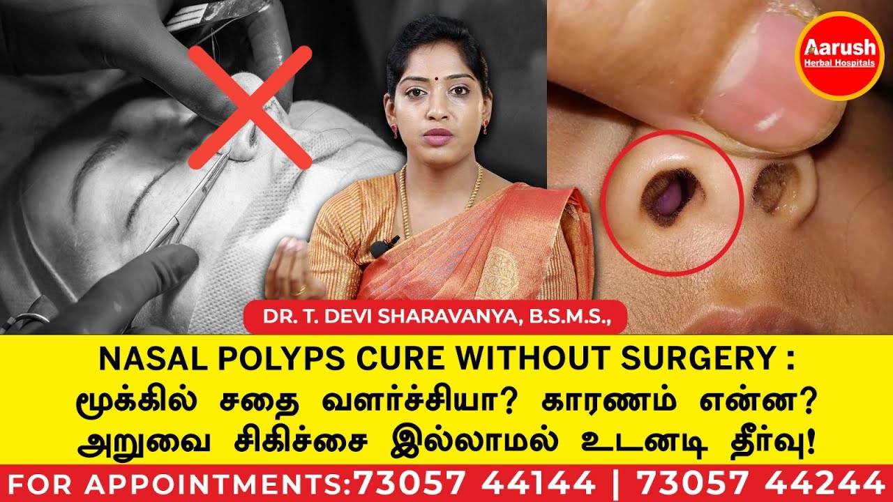 மூக்கில் சதை வளர்ச்சியா?காரணம் என்ன ?அறுவை சிகிச்சை இல்லாமல் உடனடி தீர்வு !| Aarush Herbal Hospitals