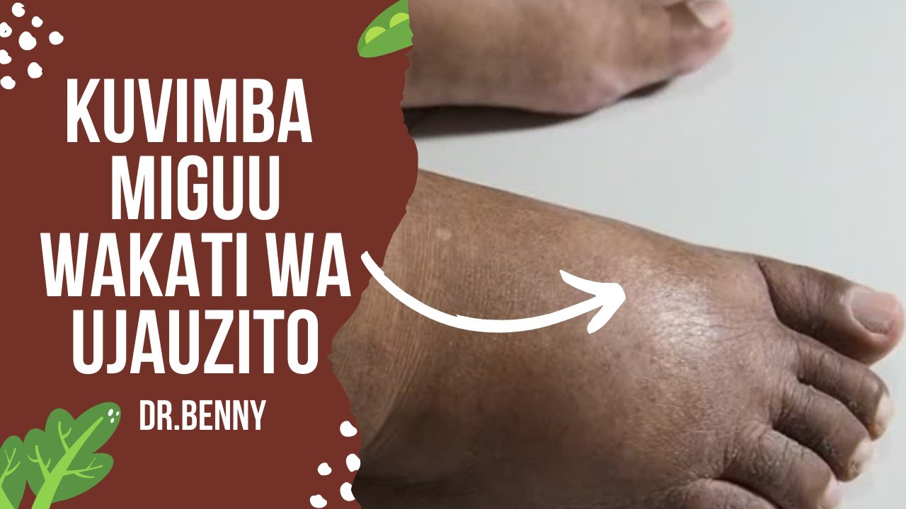 SABABU ZA KUVIMBA MIGUU WAKATI WA UJAUZITO