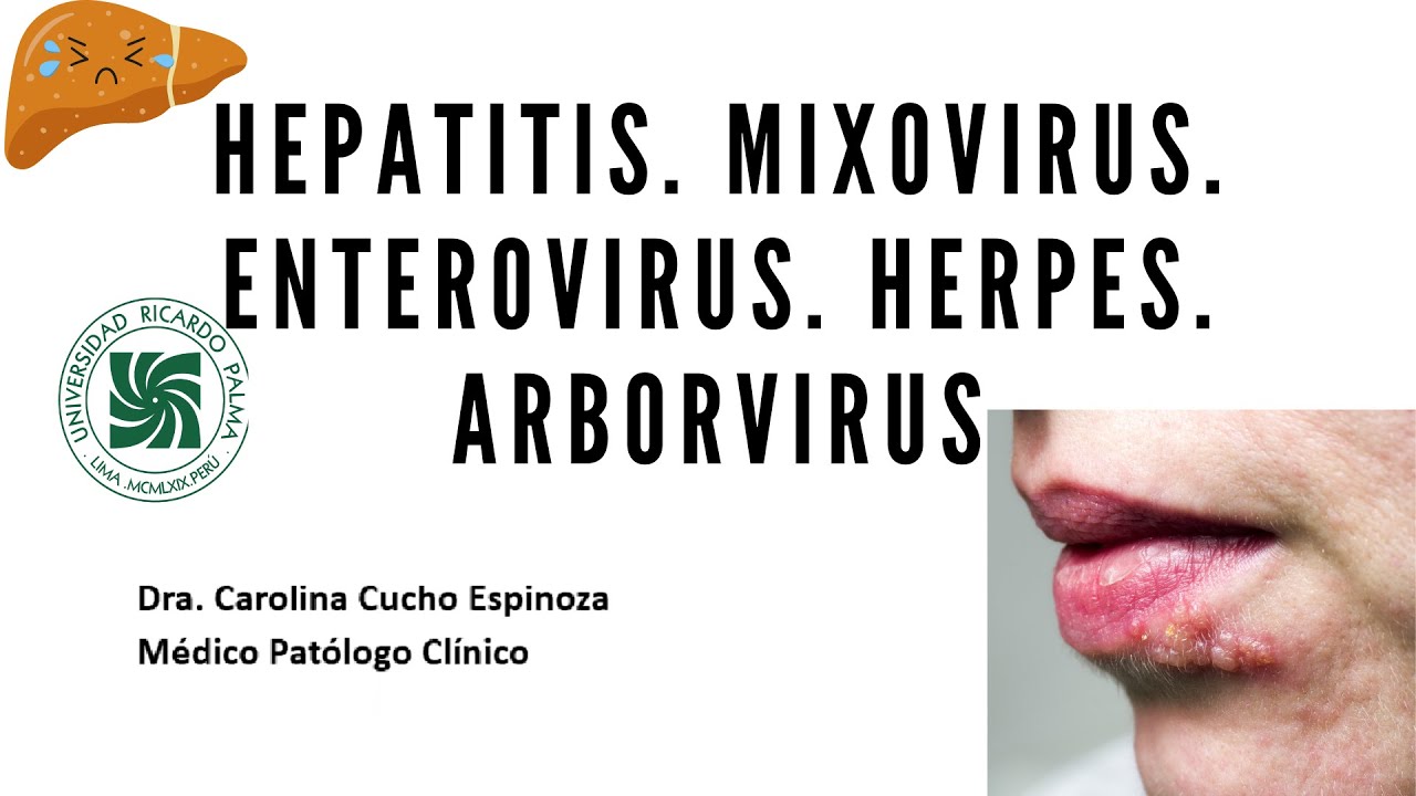 Microbiología - Hepatitis. Mixovirus. Enterovirus. Herpes. Arborvirus - Unidad3 - sem12 URP