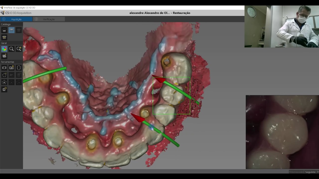Scanner Intraoral CS 3600 - Protocolo de escaneamento