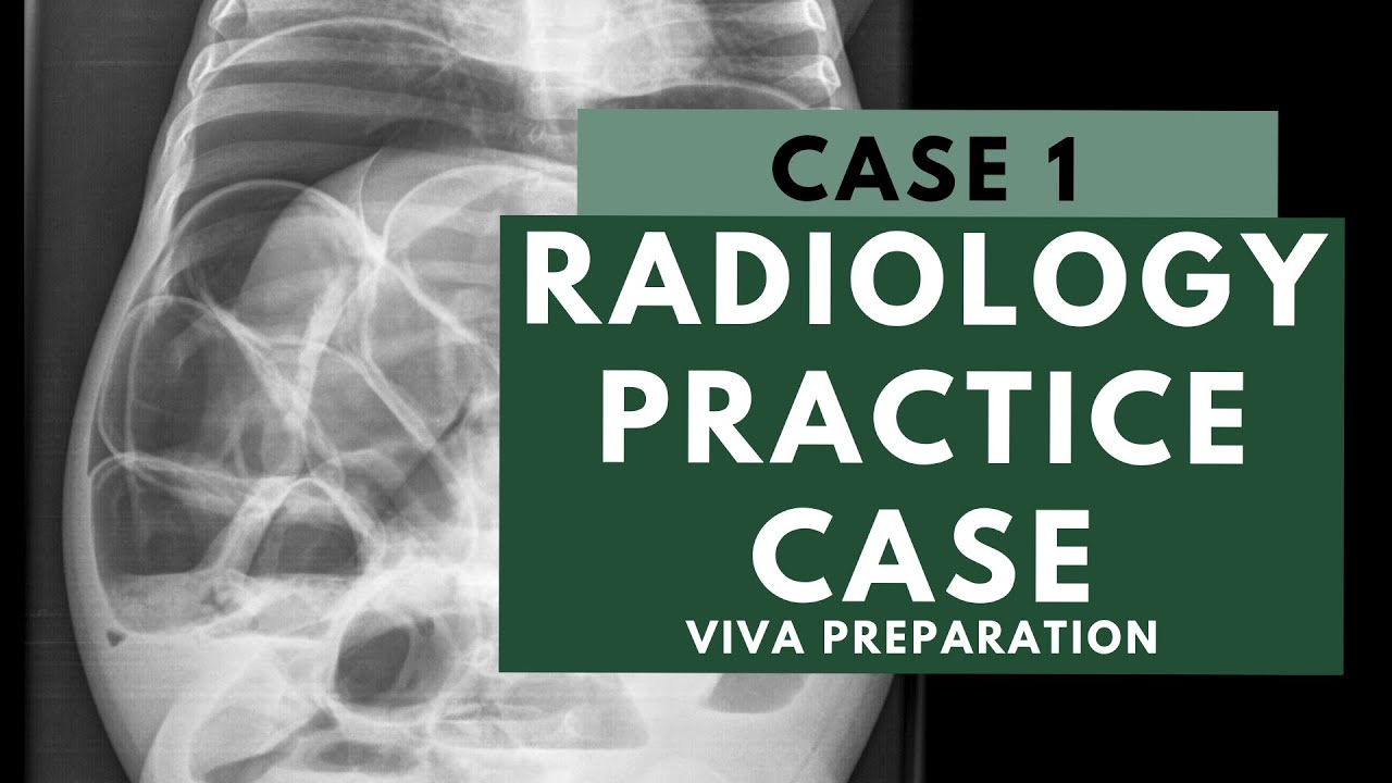 Radiology Viva Practice Case: 1 - FRCR 2B preparation