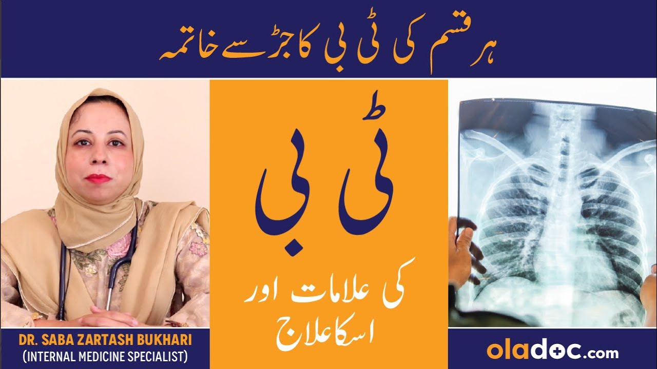 TB Ka Ilaj In Urdu - Tuberculosis Symptoms & Treatment - TB Kaise Hota Hai - Tuberculosis Infection