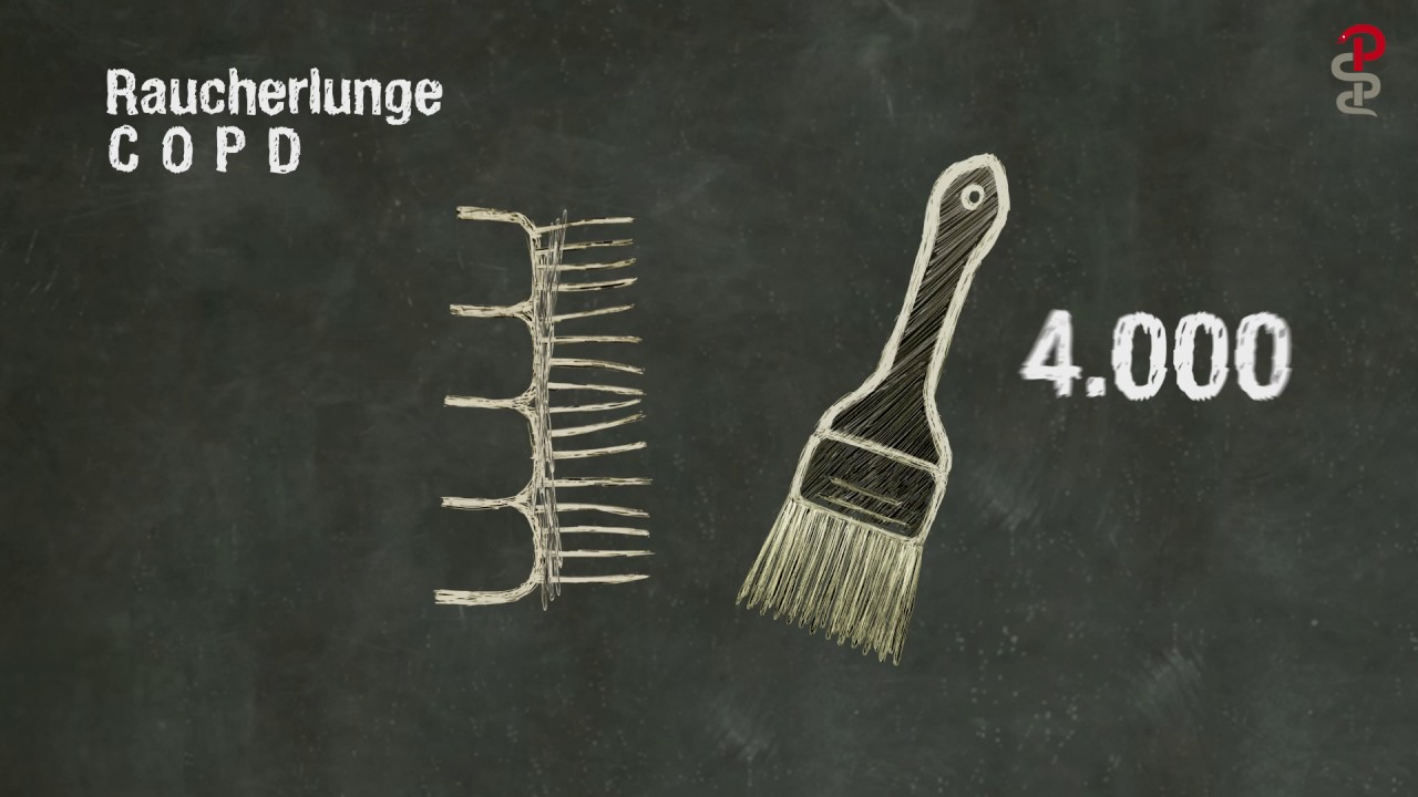 Die Raucherlunge (COPD) - und warum f&uuml;r Raucher die Luft d&uuml;nn wird