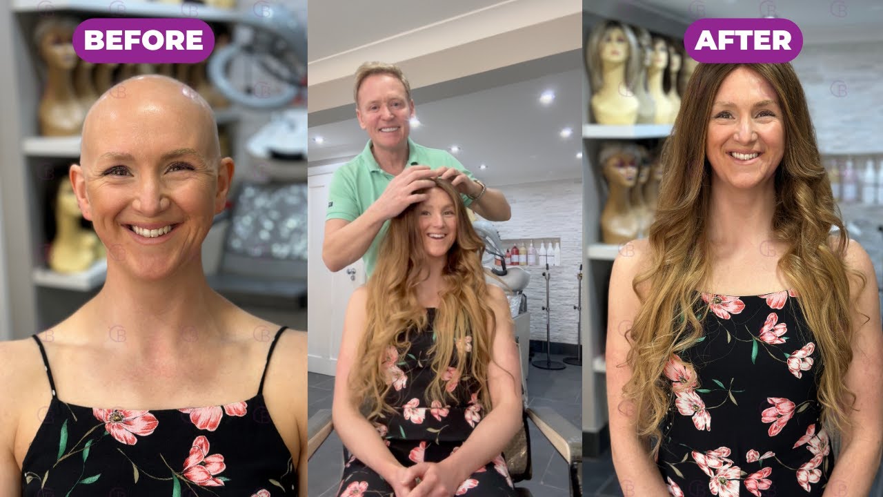 Natural looking Wigs For Alopecia Patients | Hair Wig for Bald Women | Baguley's of Cheshire