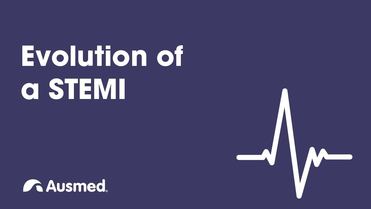 Evolution of a STEMI | Ausmed Explains...