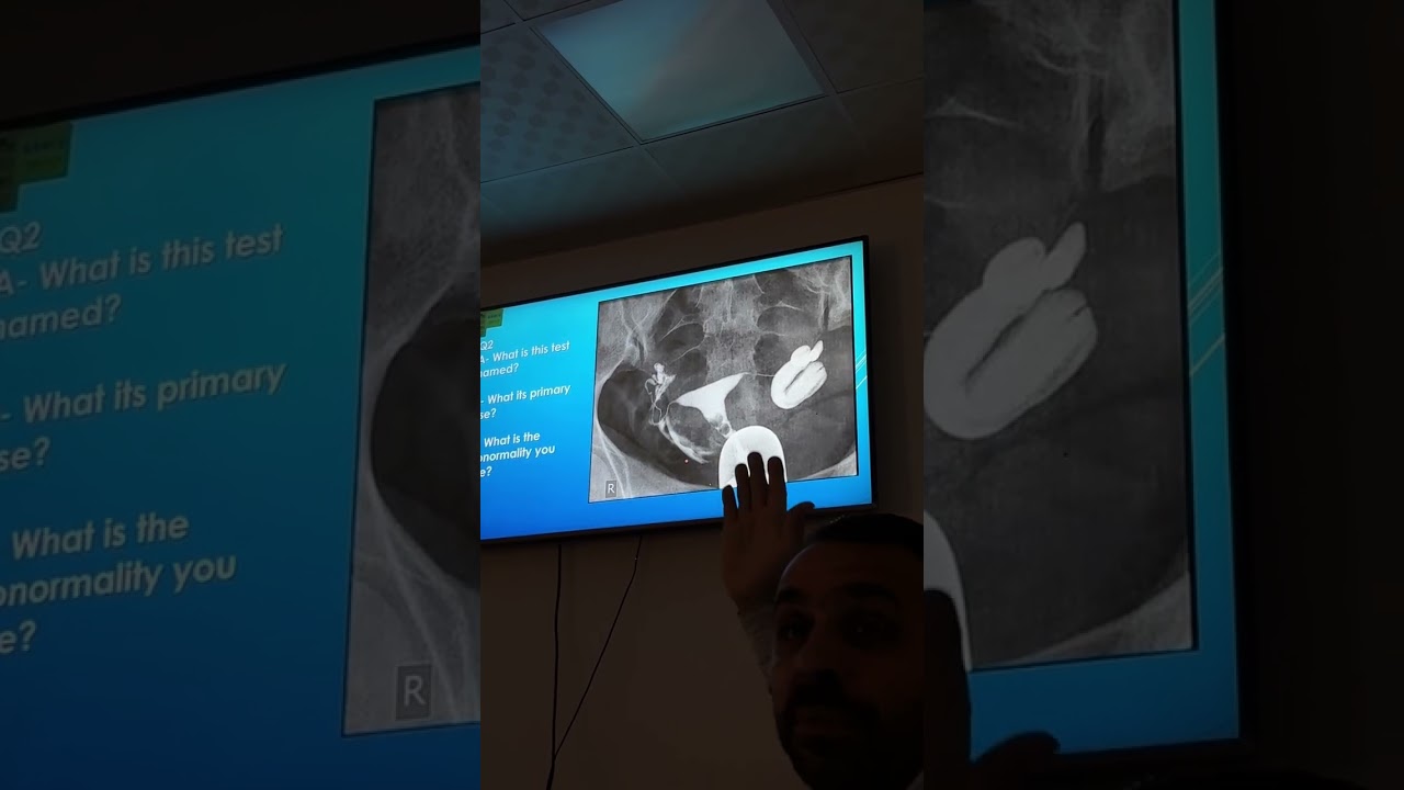 Radiology session 7 question 3