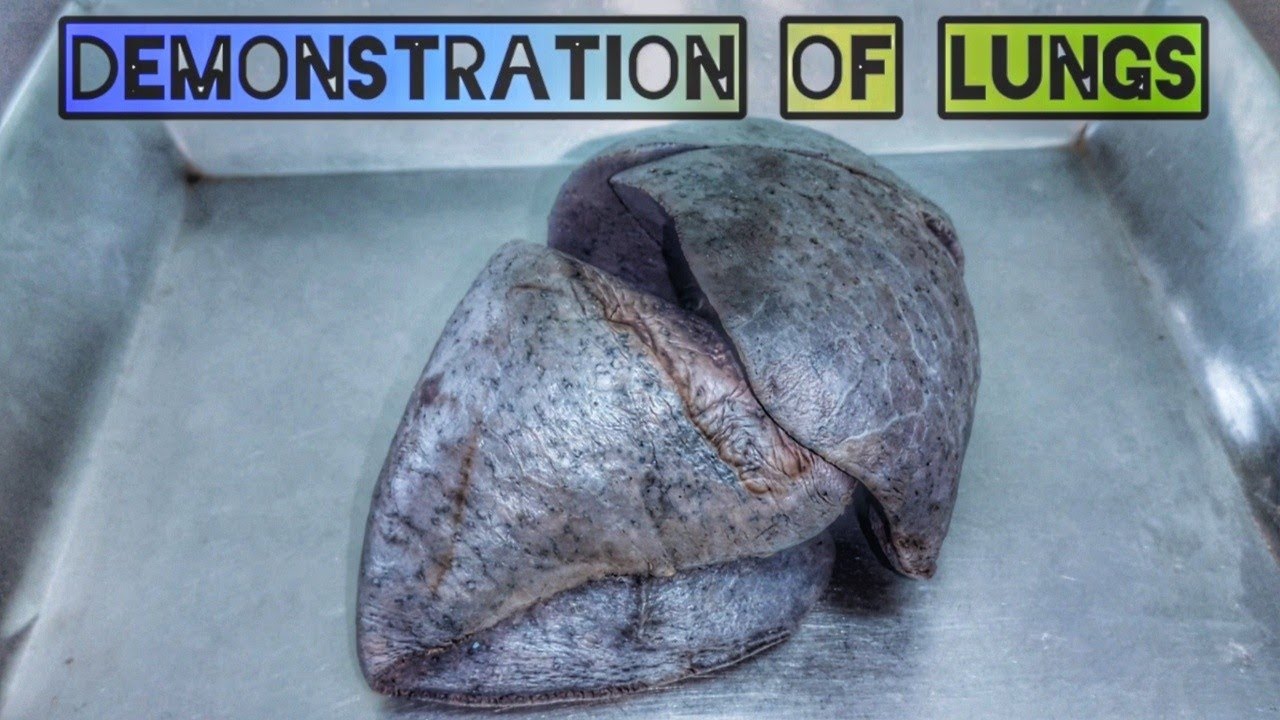 Lungs Anatomy | Bangla | Anatomy of Lungs | Demonstration of Lungs