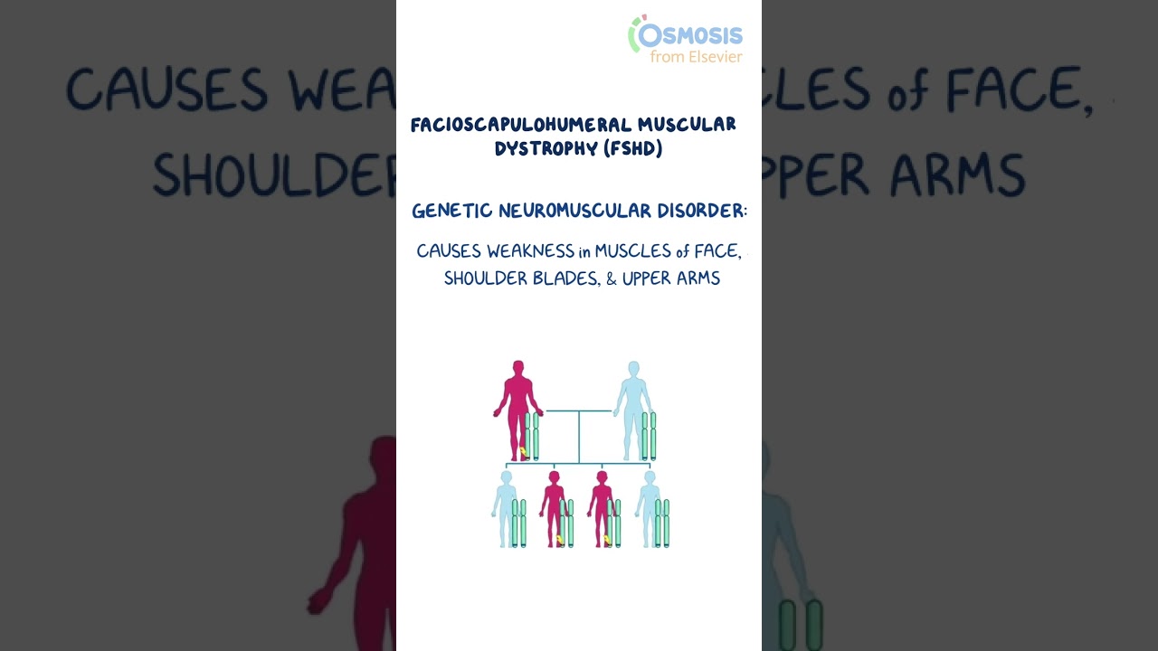 What Causes Fascioscapulohumeral Muscular Dystrophy?