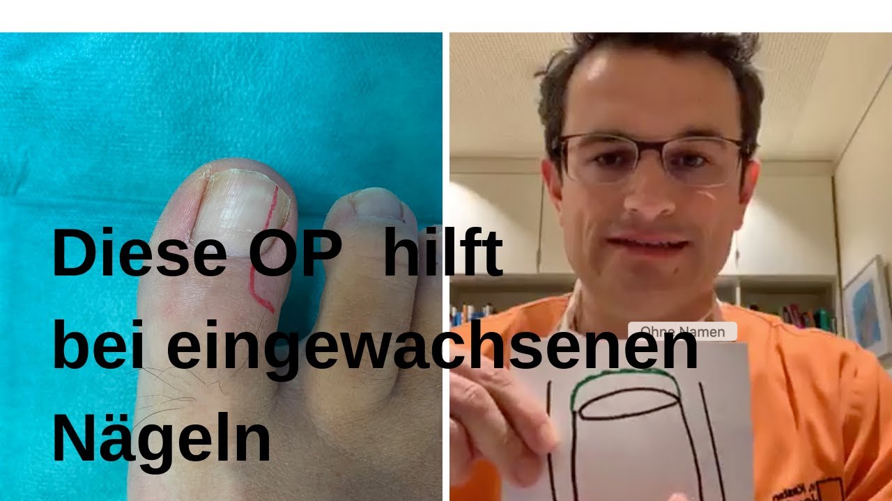 Hilfe bei eingewachsenen Zehenägeln