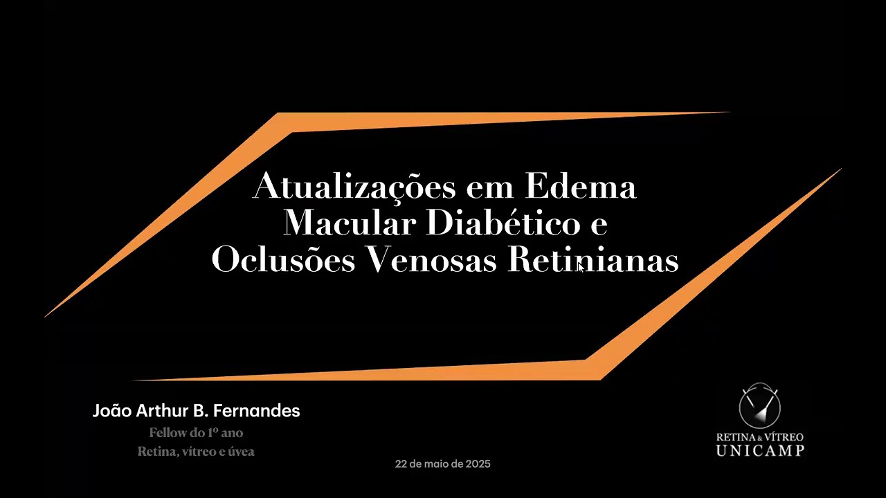 Retina e Vítreo (22/05/2025) - Atualizações em Edema Macular Diabético e Oclusões Venosas Retinianas