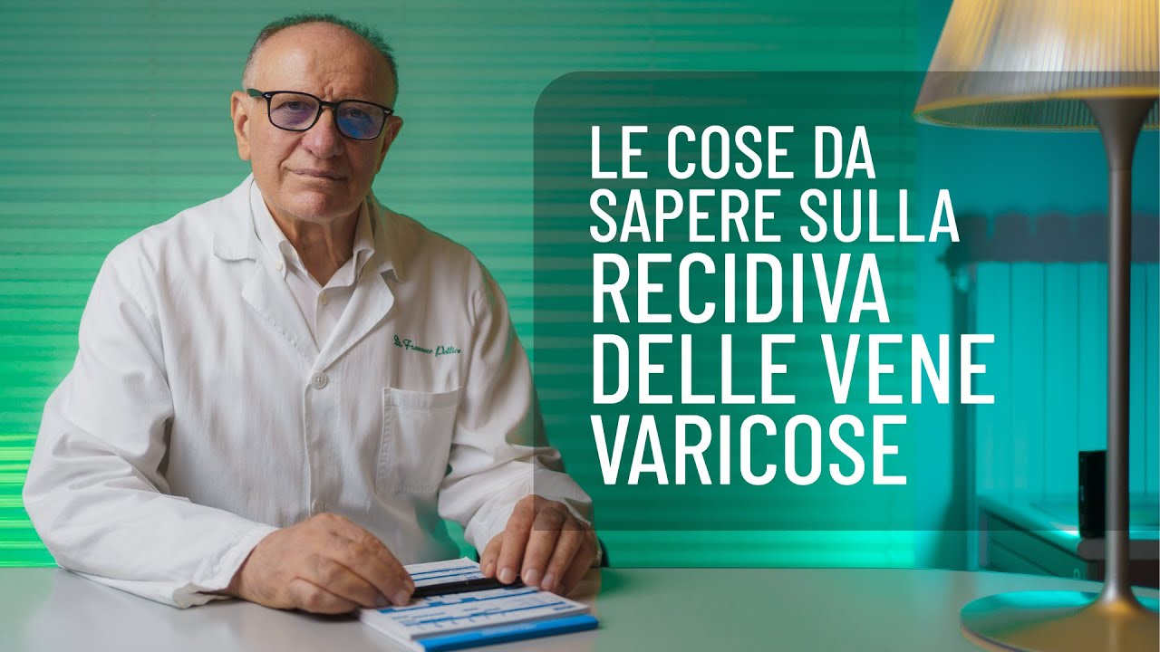 La Recidiva delle Vene Varicose: a cura del Dott. Francesco Pollice, chirurgo vascolare