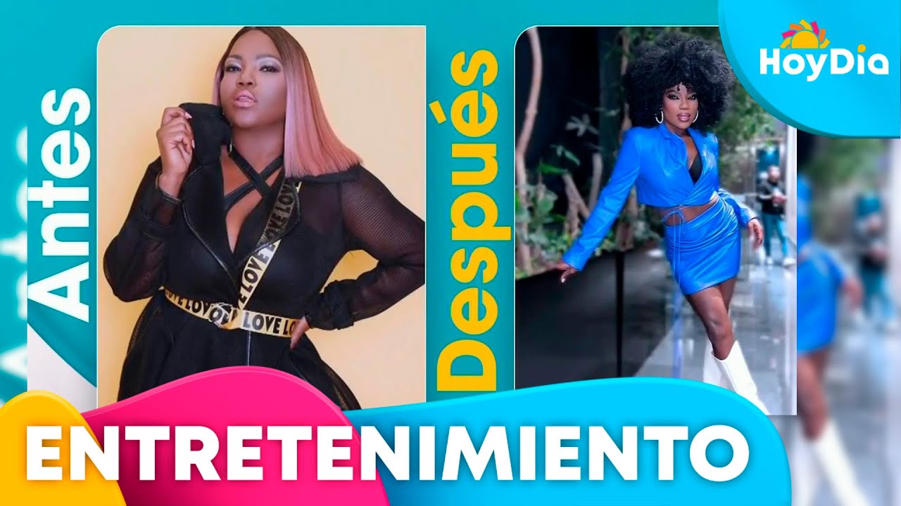 Chiky Bombom habla de su experiencia con la manga gástrica | Hoy Día | Telemundo