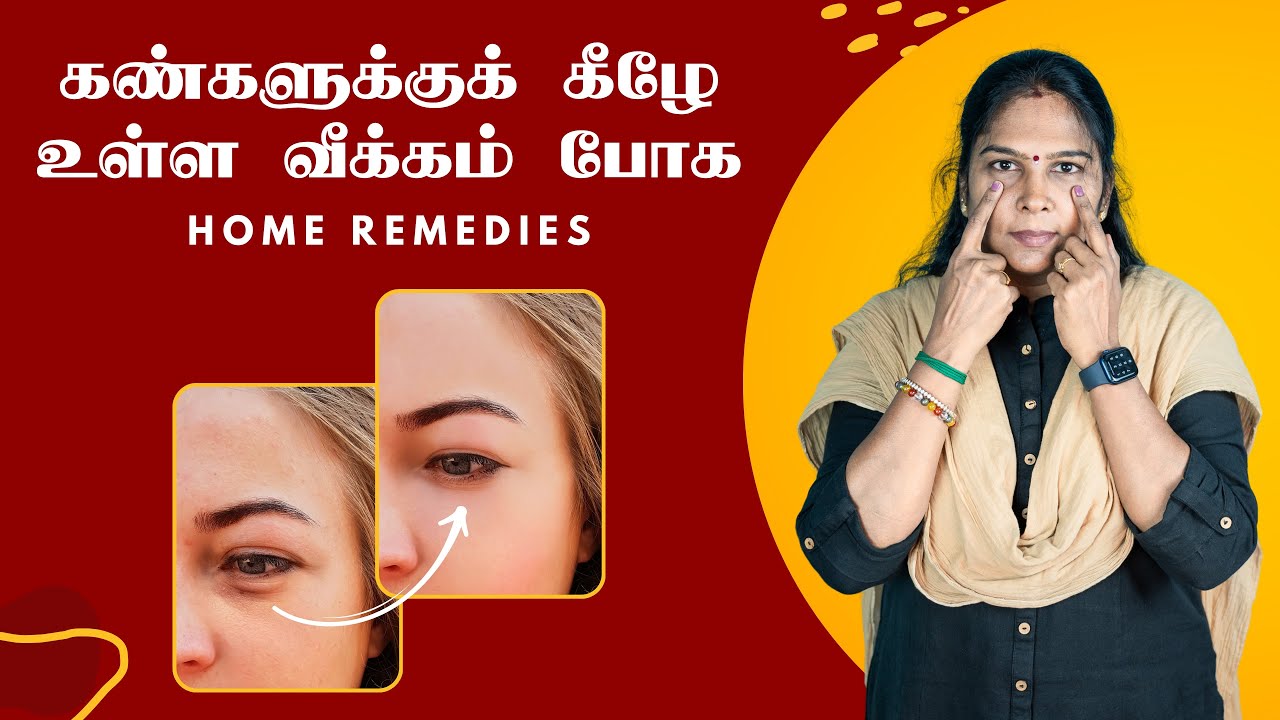 Get Rid of Under Eye Bags Naturally - Tamil Tips | கண்களுக்குக் கீழே உள்ள வீக்கம் போக #beautytips