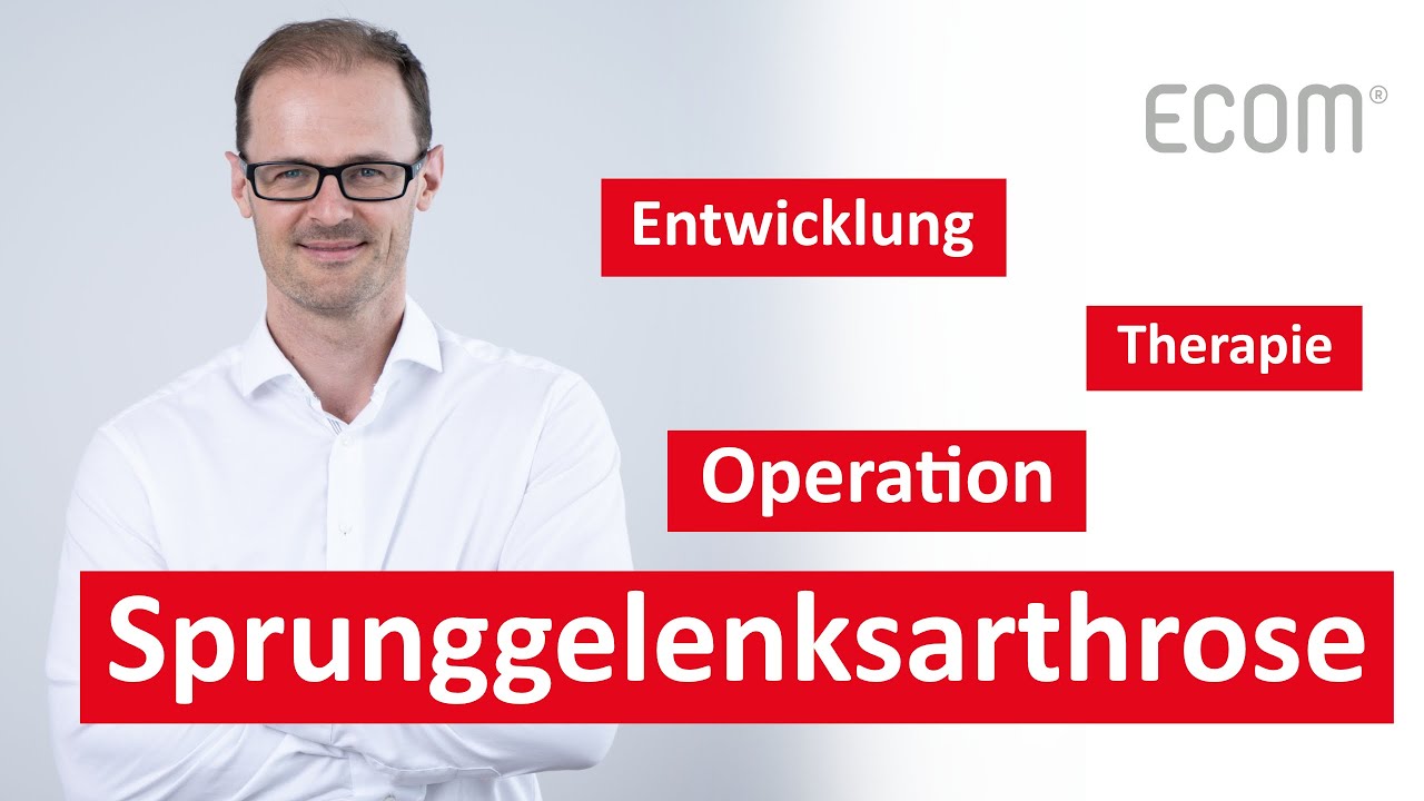 Sprunggelenksarthrose - Drei wichtige Antworten vom Spezialisten
